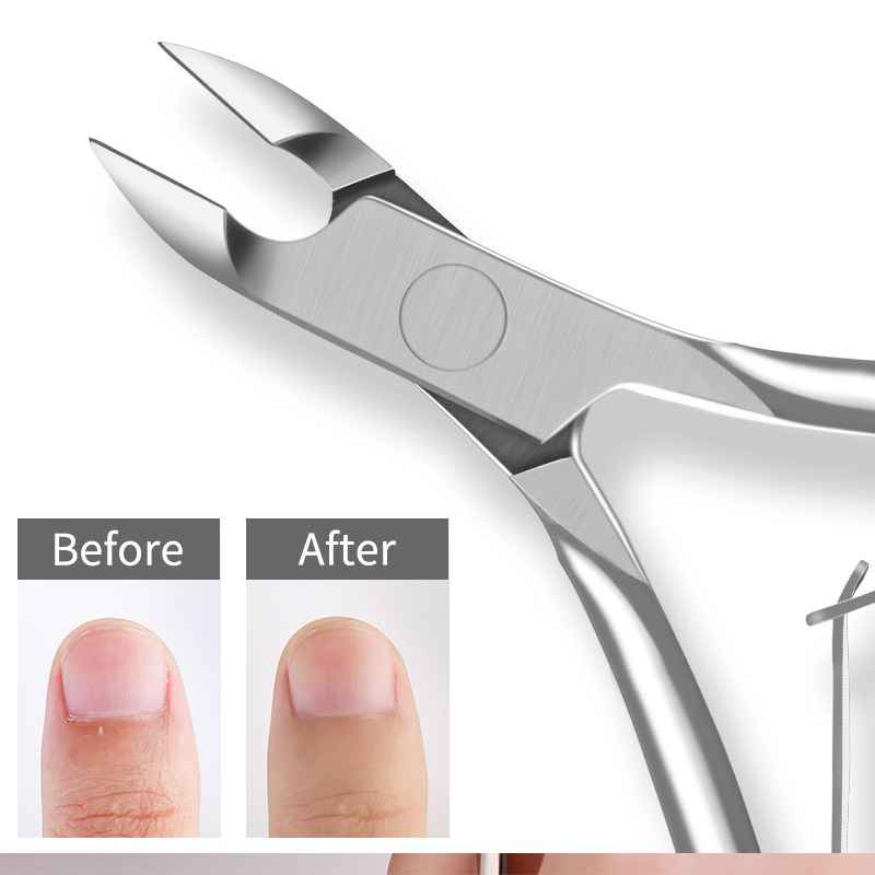 Nagelbandsklippare hjälper dig att ta bort övervuxna och flikiga nagelband.