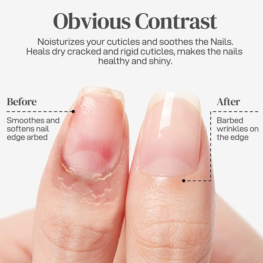 Nagelolja för nagelband Nagelbandsolja Nail & Cuticle oil för Nagelvård före och efter på kunden